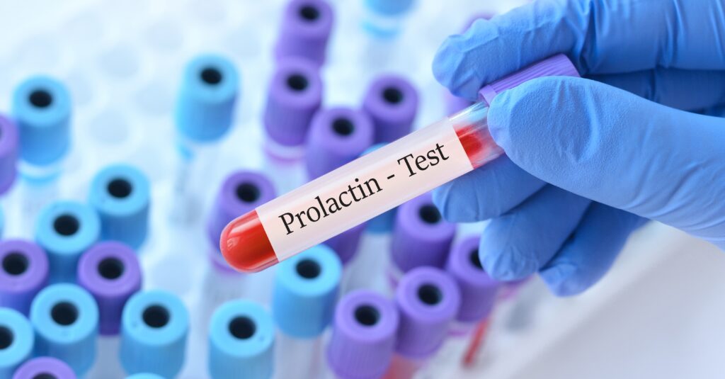prolactin test